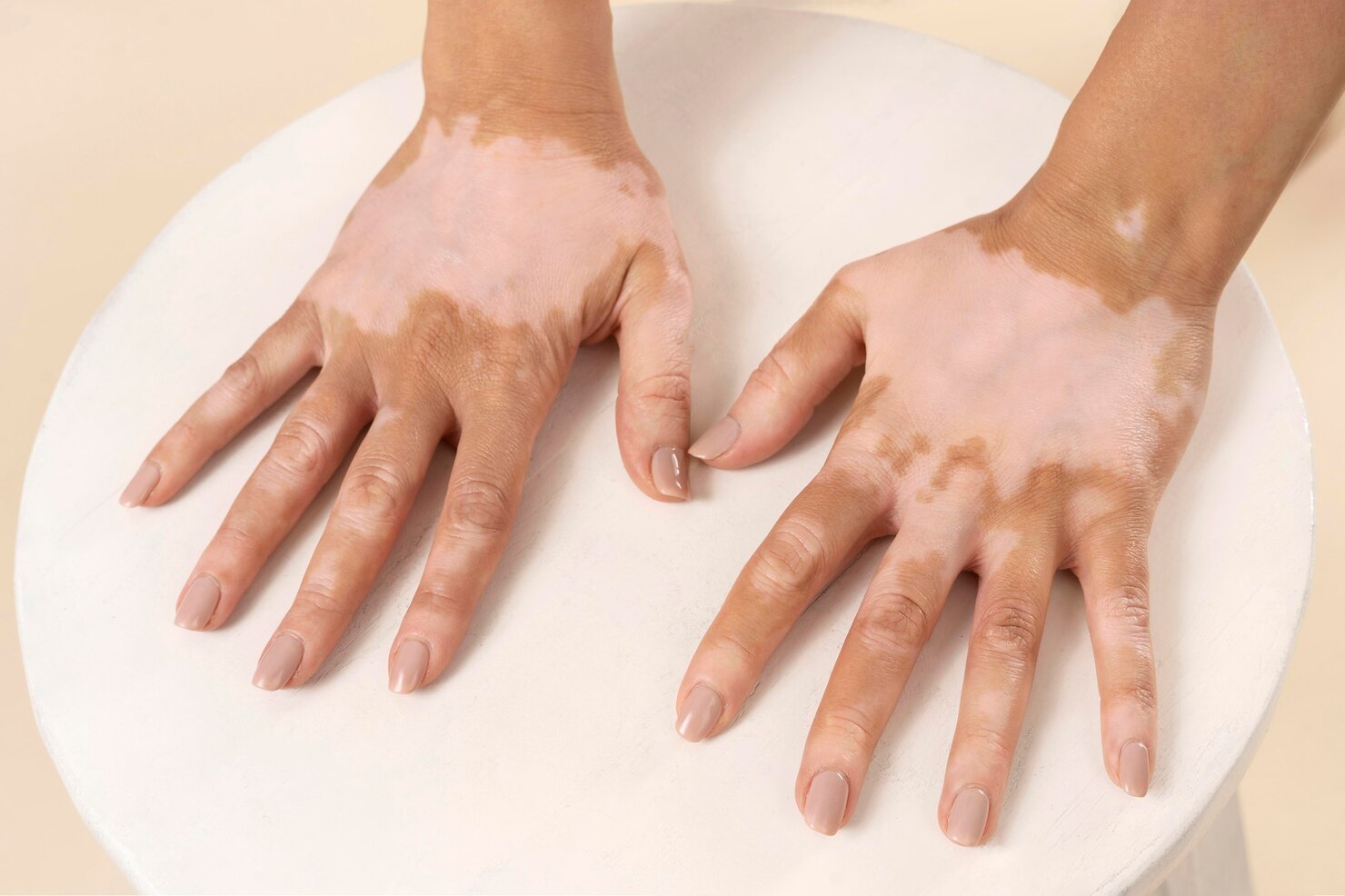 Skin Tone Matching