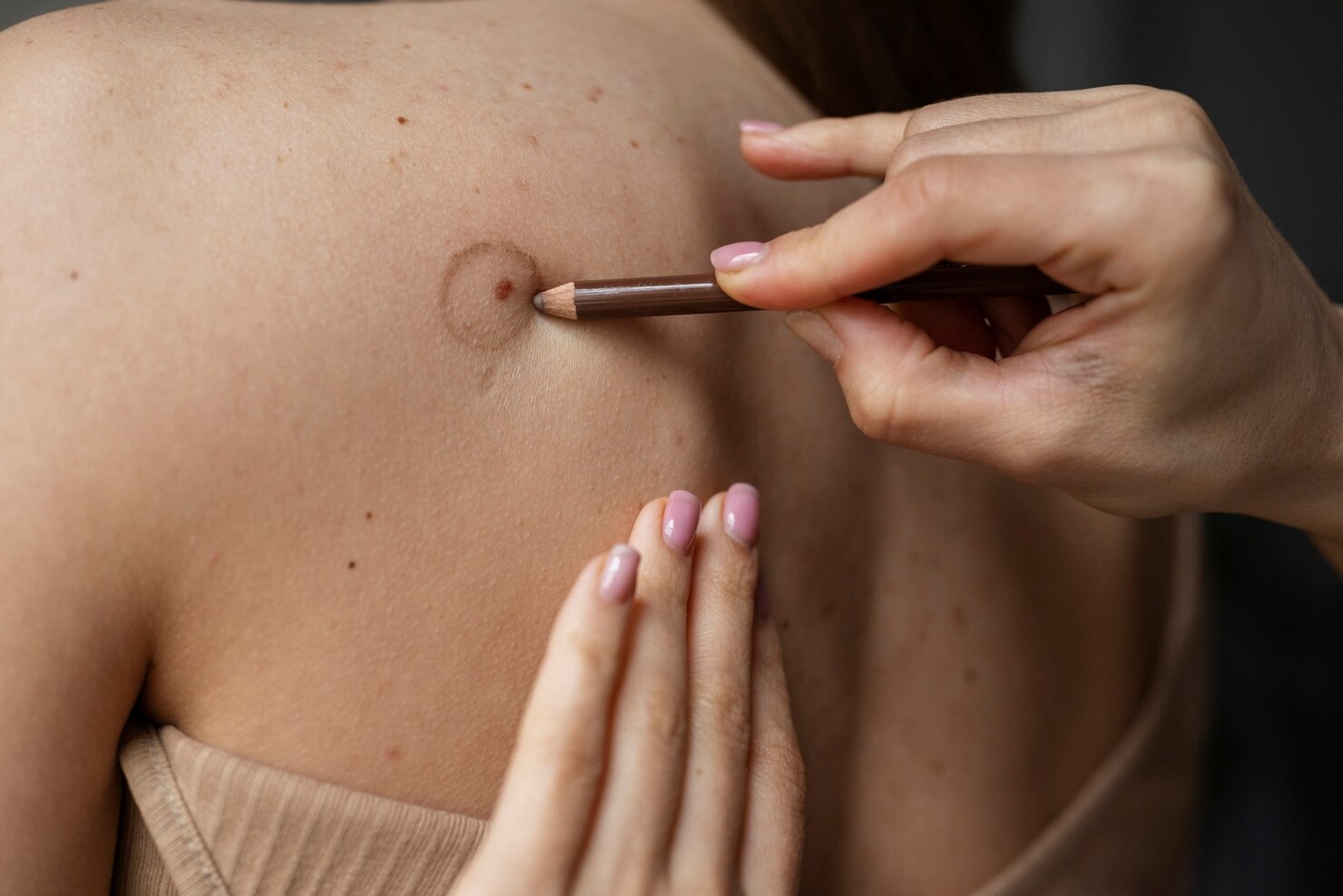 Paramedical Tattooing