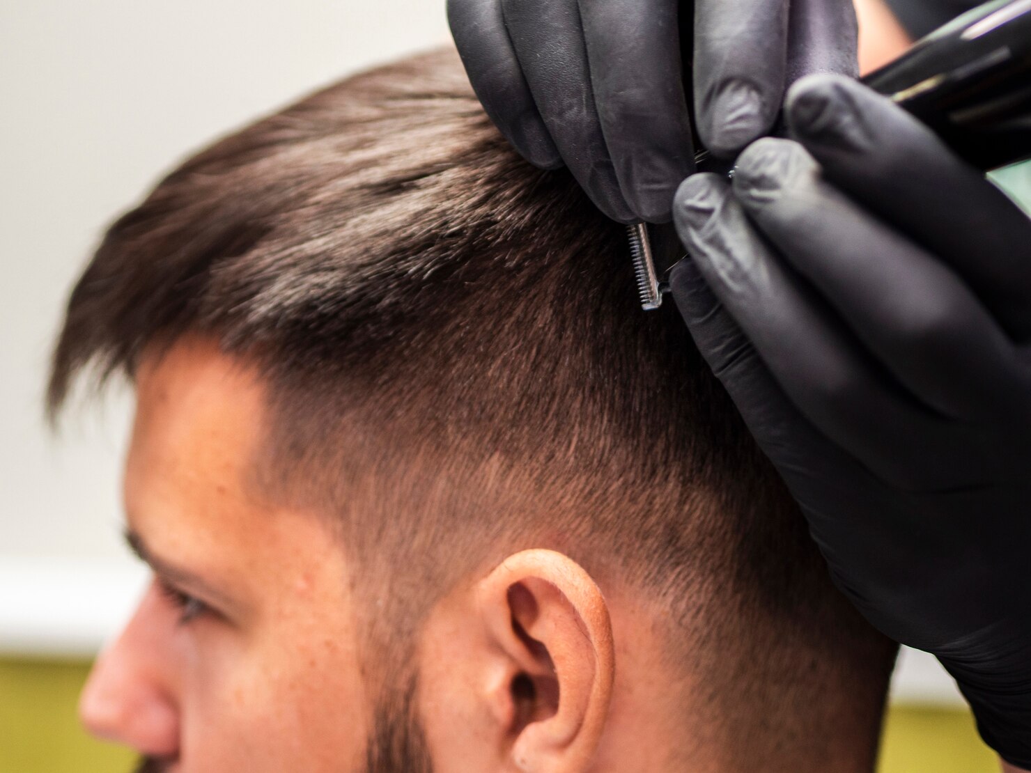 SMP for Men Treatment